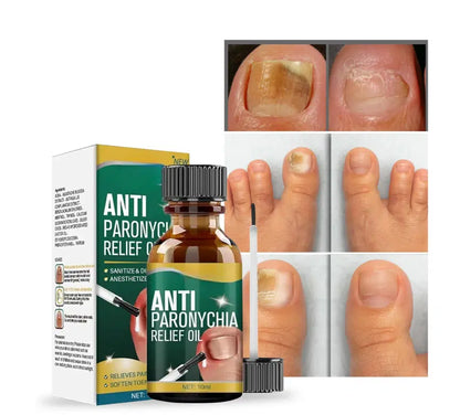 Anti Paronychia Relief Oil (Pack of 2)